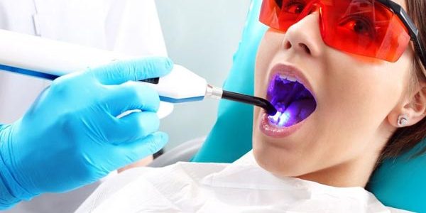 01.-laser-dental